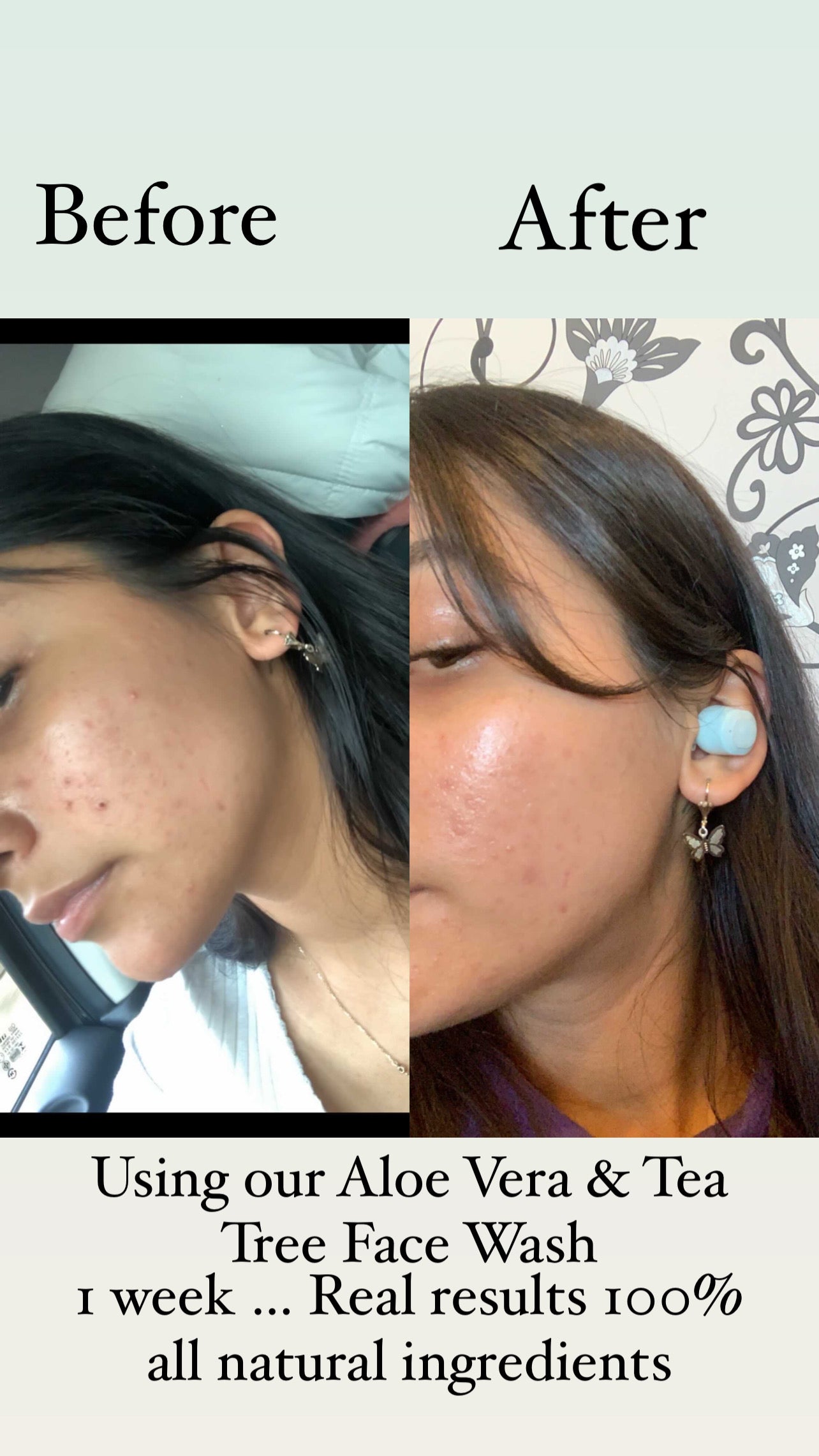 Aloe Vera & Tea Tree Face Wash